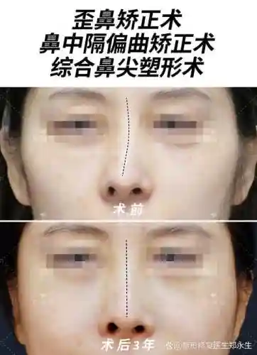 歪鼻子阵容_1插图1